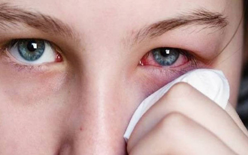 Các triệu chứng đau mắt hàn cần chú ý