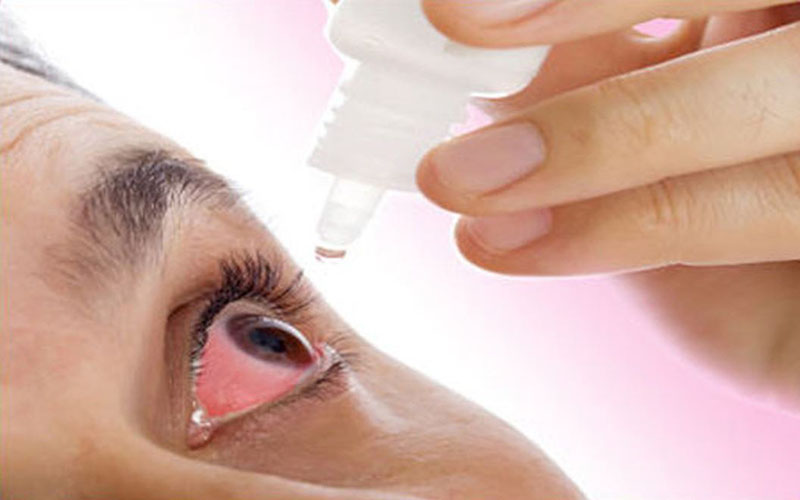 Cách xử lý tình trạng đau mắt khi hàn